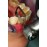 Denext Orthodontic Inter-Proximal Reduction IPR Handpiece Kit