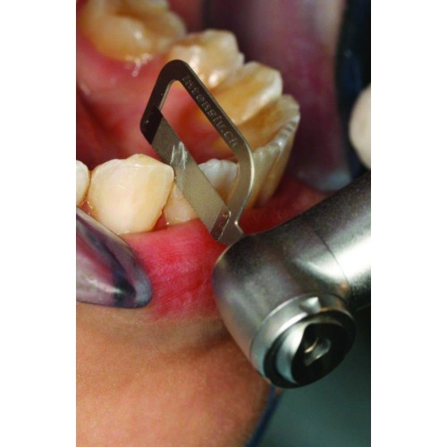 Orthodontic Interproximal Enamel Reduction Ipr Contra Corner Low Velocity Set 