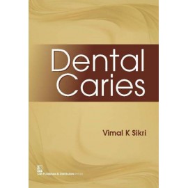 Dental Caries 