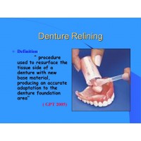 Denture Relining Materials